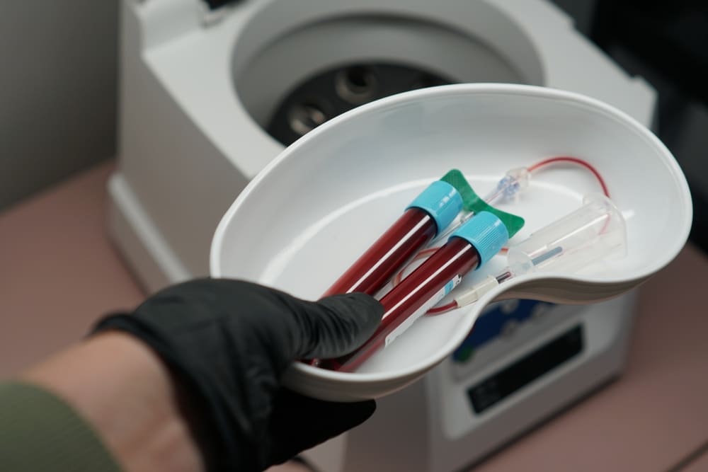 A gloved hand holds a white tray with two blood collection tubes and a needle, near a medical centrifuge.